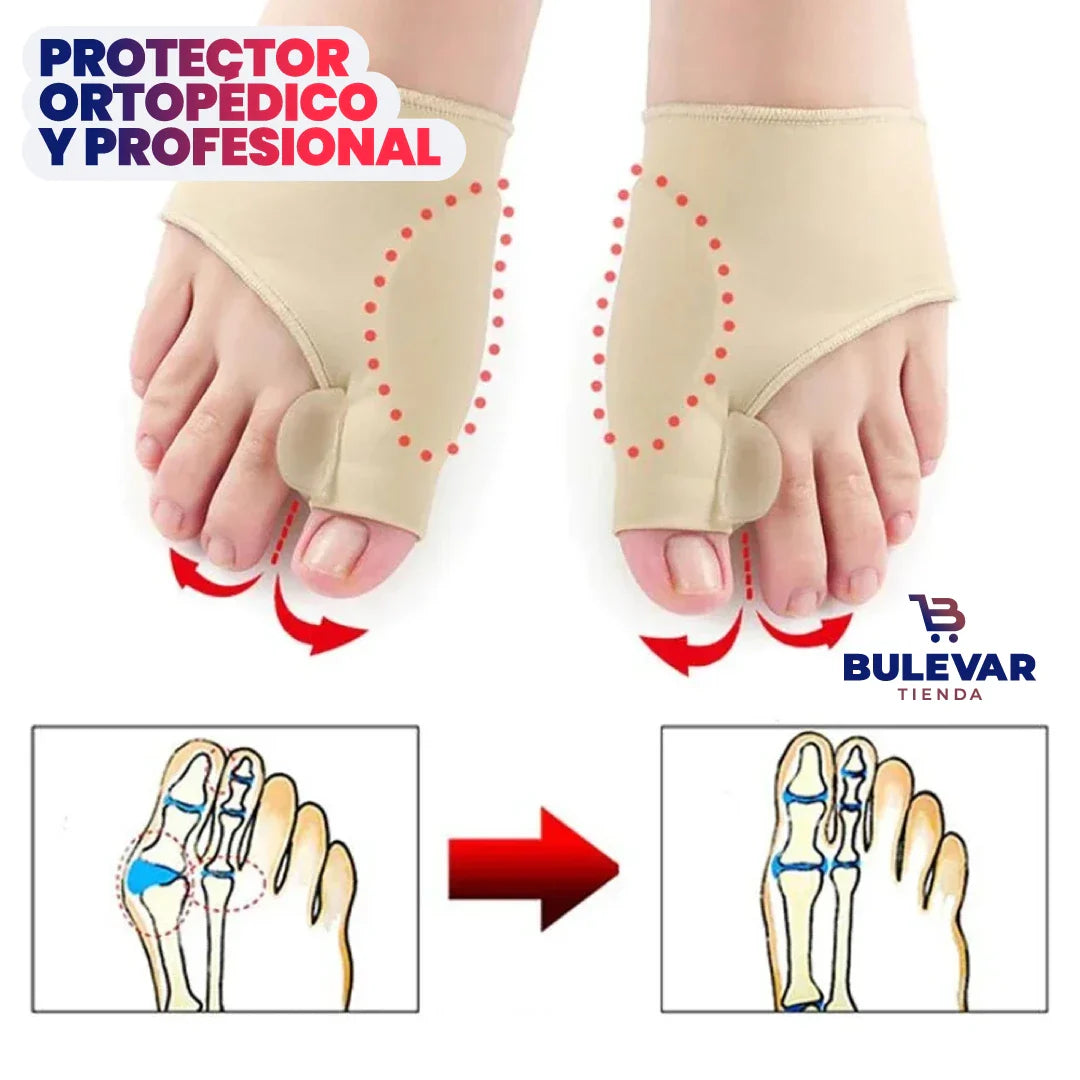 Par de Corrector de juanetes